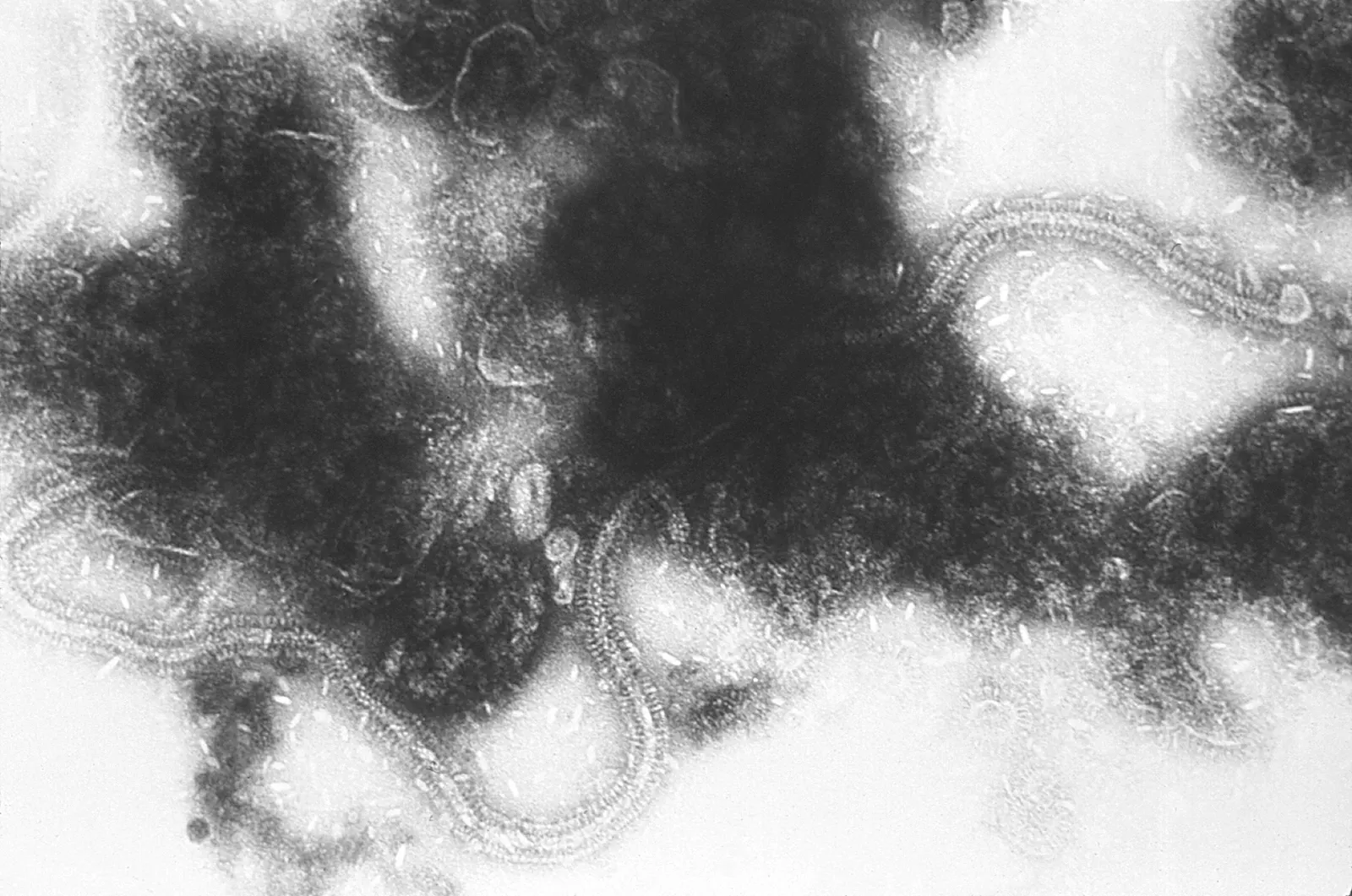 Black-and-white micrograph showing threadlike structures of the RSV RNA genome.